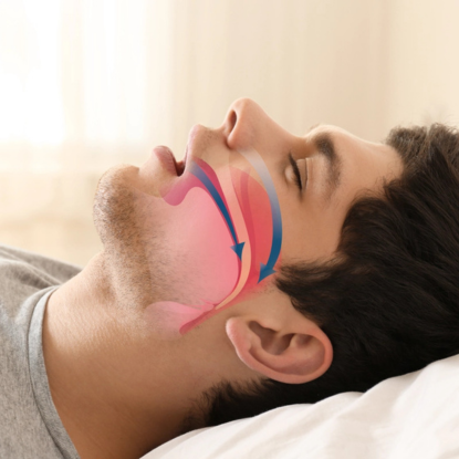 Blog: Optimizing Medical Billing for Sleep Apnea Clinics