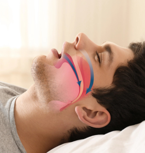 Sleep Apnea Clinic Revenue Boost Case Study